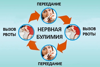 Лечение булимии в САО Москвы